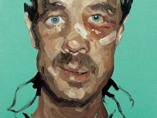 イアン・ハッチソン：顔面と人生を修復する顔面再建