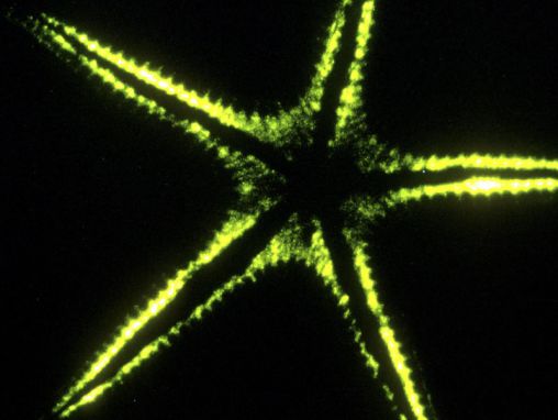 Click to play Edith Widder: O estranho e maravilhoso mundo da bioluminescência