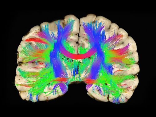 David Camarillo: Perché i caschi non prevengono le commozioni cerebrali - e cosa potrebbe farlo