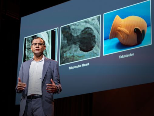 Click to play Sandeep Jauhar: Comment nos émotions changent la forme de notre cœur